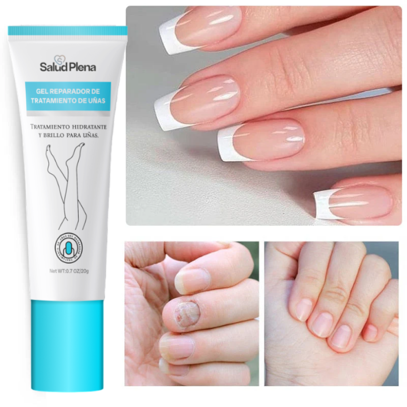 Salud Nail - Crema de eliminación de hongos + regalos [ RESULTADO COMPROBADO ]
