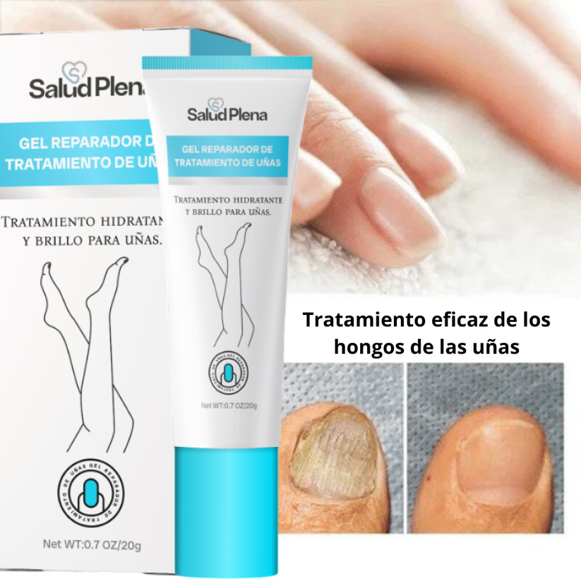 Salud Nail - Crema de eliminación de hongos + regalos [ RESULTADO COMPROBADO ]