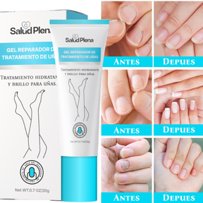 Salud Nail - Crema de eliminación de hongos + regalos [ RESULTADO COMPROBADO ]