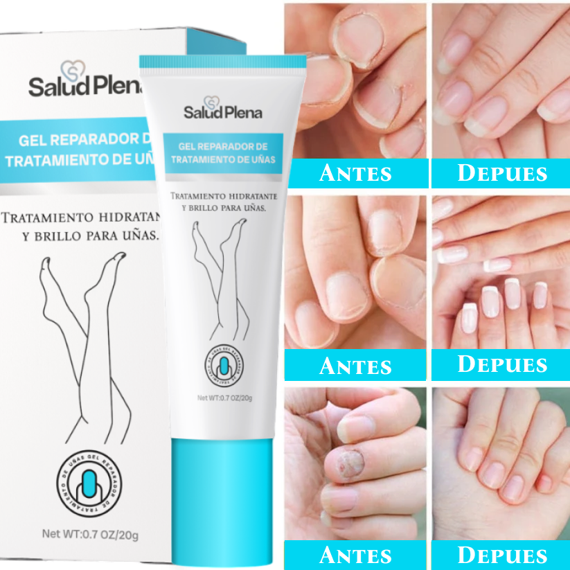 Salud Nail - Crema de eliminación de hongos + regalos [ RESULTADO COMPROBADO ]